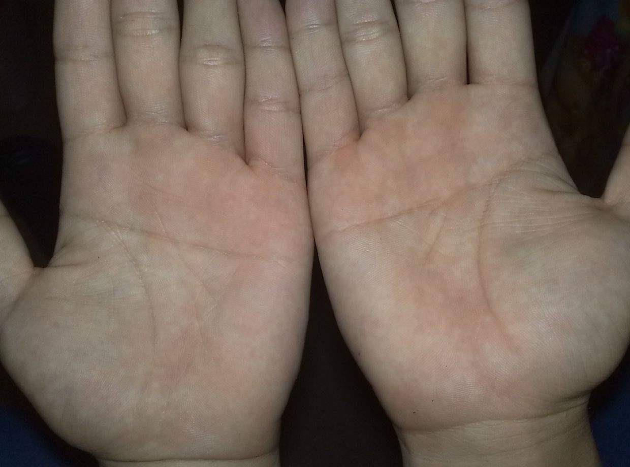 双手断掌的人有特殊的命运吗 前世经历与掌纹有何关联